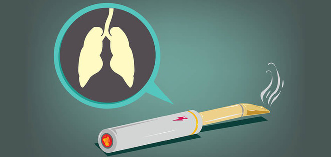 Thuốc Lá Điện Tử Không Hề An Toàn: Đã Có Bằng Chứng Cho Thấy Nó Gây Ung Thư Phổi